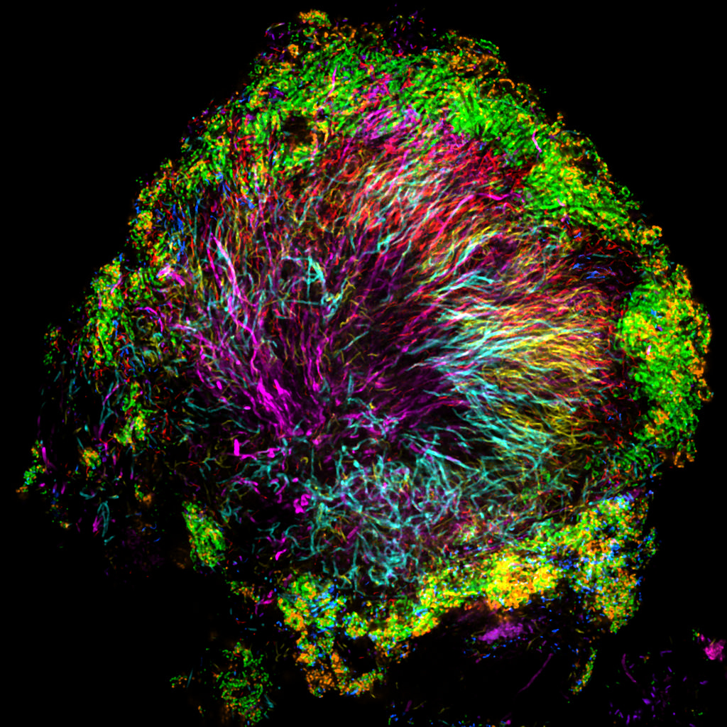 I, Holobiont: Are You and Your Microbes a Community or a Single Entity?