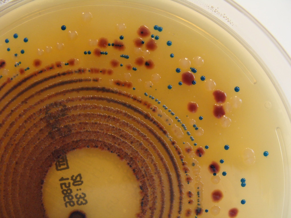 This Microbe is Spreading Antibiotic Resistance to Other Bacteria